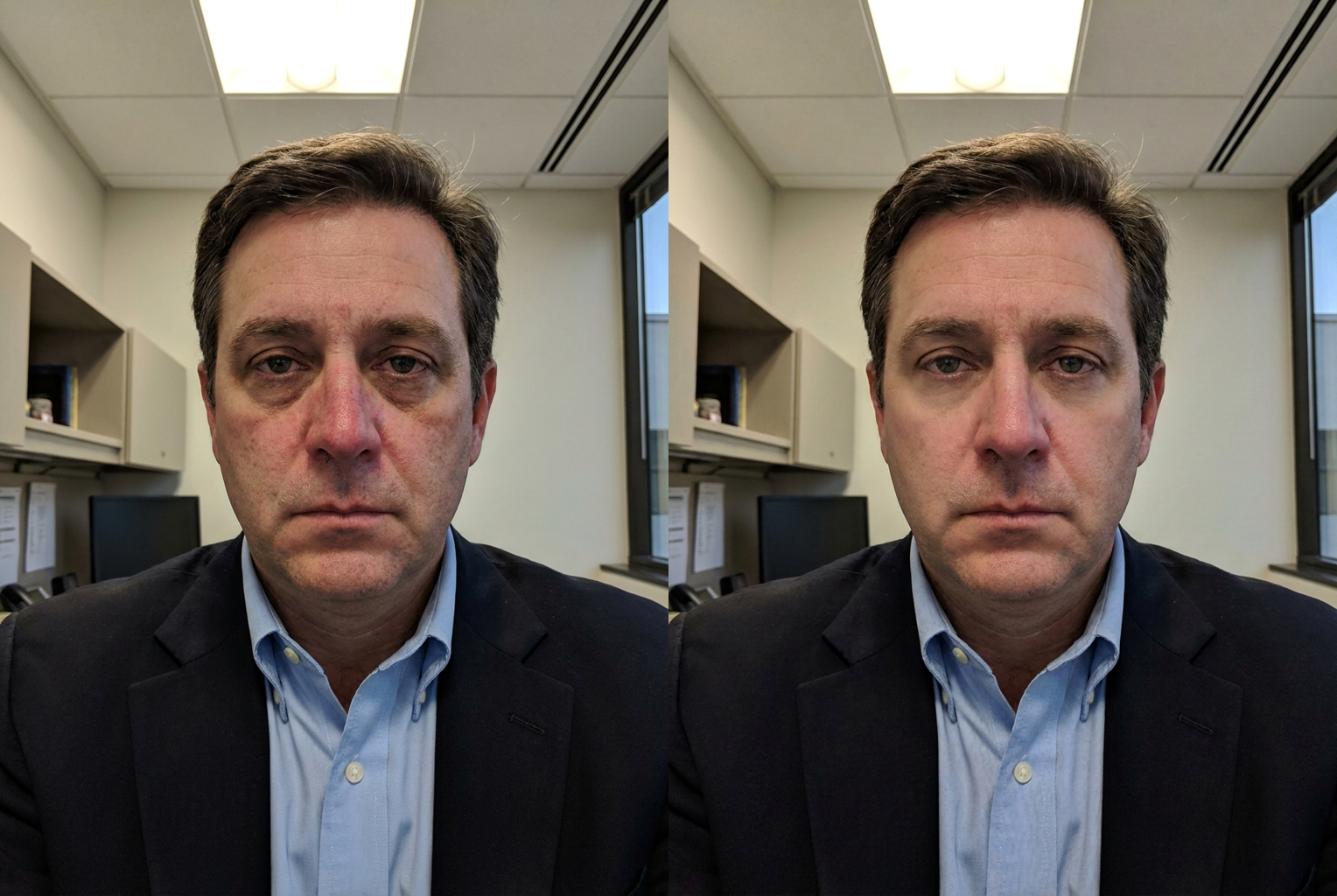 Before → After: dark circles + redness + lighting fix